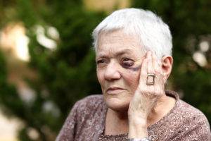 How Common Is Elder Abuse?