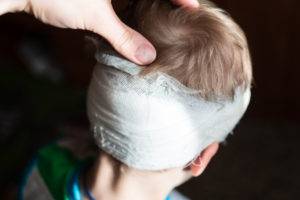 Mount Vernon Child Injury Lawyer