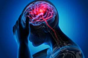 What is the Statute of Limitations for Brain Injury Claims?